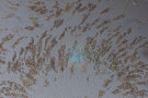 Dutzende Pilzsporen unter Lichtmikroskop.